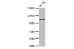 Western Blot<br />
Positive WB detected in:HL-60 whole cell lysate<br />
All lanes:Cd163 antibody at 3