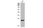 Western blot analysis of 3T3 lysis using CKLF antibody.. Secondary antibody  was diluted at 1:20000