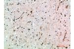 Immunohistochemical analysis of paraffin-embedded human-brain, antibody was diluted at 1:200