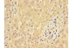 Immunohistochemistry of paraffin-embedded human liver tissue using CSB-PA659641LA01HU at dilution of 1:100
