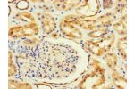 Immunohistochemistry of paraffin-embedded human kidney tissue using CSB-PA660753LA01HU at dilution of 1:100