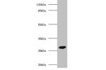 Western blot<br />
All lanes:Adiponectin antibody at 2ug/ml+recombinant Adiponectin protein 0.1ugSecondary<br />
Goat polyclonal to Rabbit IgG at 1/10000 dilution<br />
Predicted band size: 26kDa<br />
Observed band size: 26kDa<br />