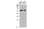 Western Blot analysis of mouse-brain mouse-lung cells using Beclin-1 Polyclonal Antibody diluted at 1:500. Secondary antibody  was diluted at 1:20000