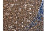 The image on the left is immunohistochemistry of paraffin-embedded Human tonsil tissue using CSB-PA665086(FOLH1B Antibody) at dilution 1/20, on the right is treated with synthetic peptide. (Original magnification: 
