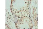 Immunohistochemistry of paraffin-embedded human testis tissue using CSB-PA667562ESR1HU at dilution of 1:100