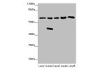 Western blot<br />
All lanes: FBXO7 antibody at 3.97 ug/ml<br />
Lane 1 : Mouse gonadal tissue<br />
Lane 2 : Mouse brain tissue<br />
Lane 3 : Jurkat whole cell lysate<br />
Lane 4 : 293T whole cell lysate<br />
Lane 5 : PC-3 whole cell lysate<br />
Seco