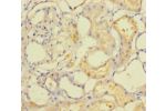 Immunohistochemistry of paraffin-embedded human kidney tissue using CSB-PA668210LA01HU at dilution of 1:100