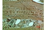 Immunohistochemical analysis of paraffin-embedded human-muscle, antibody was diluted at 1:200