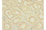 Immunohistochemistry of paraffin-embedded human kidney tissue CSB-PA669847LA01HU at dilution 1:100