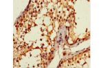 Immunohistochemistry of paraffin-embedded human