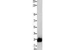 Gel: 10%SDS-PAGE, Lysate: 30 