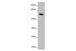 Western blot<br />
All lanes: CERKL antibody at 14 ug/ml+ Mouse lung tissue<br />
Secondary<br />
Goat polyclonal to rabbit IgG at 1/10000 dilution<br />
Predicted band size: 63,60,53,48,43,25,20,58 kDa<br />
Observed band size: 63 kDa<br />