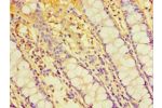 Immunohistochemistry of paraffin-embedded human rectum tissue using CSB-PA670962ESR1HU at dilution 1:100