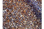 The image on the left is immunohistochemistry of paraffin-embedded Human tonsil tissue using CSB-PA671607(BIRC6 Antibody) at dilution 1/50, on the right is treated with synthetic peptide. (Original magnification: 