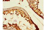 Immunohistochemistry of paraffin-embedded human testicular tissue using CSB-PA673367LA01HU at dilution of 1:100