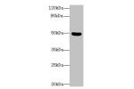 Western blot<br />
All lanes: C5orf22 antibody at 8ug/ml+ Mouse brain tissue<br />
Goat polyclonal to rabbit at 1/10000 dilution<br />
Predicted band size: 50,21,19 kDa<br />
Observed band size: 50 kDa<br />
