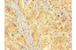 Immunohistochemistry of paraffin-embedded human adrenal gland tissue using CSB-PA676570LA01HU at dilution of 1:100