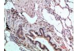 Immunohistochemical analysis of paraffin-embedded human-lung, antibody was diluted at 1:200