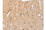 The image on the left is immunohistochemistry of paraffin-embedded Human brain tissue using CSB-PA678542(BRCA1 Antibody) at dilution 1/25, on the right is treated with fusion protein. (Original magnification: 