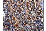 The image is immunohistochemistry of paraffin-embedded Human tonsil tissue using CSB-PA679990(COX16 Antibody) at dilution 1/50. (Original magnification: 