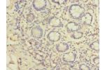 Immunohistochemistry of paraffin-embedded human small intestine tissue using CSB-PA681508LA01HU at dilution of 1:100