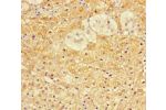 Immunohistochemistry of paraffin-embedded human adrenal gland tissue using CSB-PA683360LA01HU at dilution of 1:100