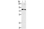 Gel: 6%SDS-PAGE, Lysate: 40 