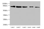 Western blot<br />
All lanes: ACSBG2 antibody at 5ug/ml<br />
Lane 1 : Hela whole cell lysate<br />
Lane 2 : K562 whole cell lysate<br />
Lane 3 : A549 whole cell lysate<br />
Lane 4 : Human high value serumLane 5 : A431 whole cell lysate<br />
Secondary<