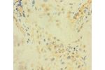 Immunohistochemistry of paraffin-embedded human placenta tissue using CSB-PA685925LA01HU at dilution 1:100