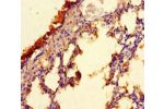 Immunohistochemistry of paraffin-embedded human lung tissue using CSB-PA686386LA01HU at dilution of 1:100
