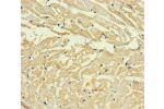 Immunohistochemistry of paraffin-embedded human heart tissue using CSB-PA687370LA01HU at dilution of 1:100