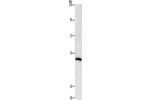 Gel: 8%SDS-PAGE, Lysate: 40 