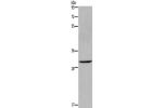 Gel: 8%SDS-PAGE,Lysate: 40 