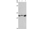 Gel: 8%SDS-PAGE, Lysate: 40 