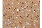 The image on the left is immunohistochemistry of paraffin-embedded Human brain tissue using CSB-PA695187(CRMP1 Antibody) at dilution 1/15, on the right is treated with synthetic peptide. (Original magnification: 