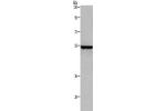 Gel: 8%SDS-PAGE, Lysate: 40 