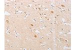 The image on the left is immunohistochemistry of paraffin-embedded Human brain tissue using CSB-PA696531(CDKN2AIP Antibody) at dilution 1/20, on the right is treated with fusion protein. (Original magnification: 