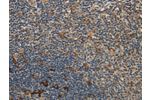 The image on the left is immunohistochemistry of paraffin-embedded Human tonsil tissue using CSB-PA698514(GGT1 Antibody) at dilution 1/40, on the right is treated with fusion protein. (Original magnification: 