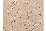 The image is immunohistochemistry of paraffin-embedded Human brain tissue using CSB-PA698913(CKMT2 Antibody) at dilution 1/60. (Original magnification: 