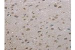 The image on the left is immunohistochemistry of paraffin-embedded Human brain tissue using CSB-PA699536(FAP Antibody) at dilution 1/30, on the right is treated with fusion protein. (Original magnification: 