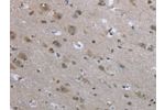 The image on the left is immunohistochemistry of paraffin-embedded Human brain tissue using CSB-PA699881(EGFL8 Antibody) at dilution 1/40, on the right is treated with fusion protein. (Original magnification: 