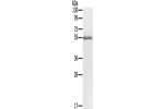 Gel: 8%SDS-PAGE, Lysate: 60 