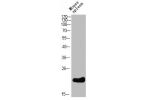 Western Blot analysis of mouse-spleen cells using Bcl-2 Polyclonal Antibody diluted at 1:500. Secondary antibody  was diluted at 1:20000