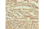 Immunohistochemistry of paraffin-embedded human heart tissue using CSB-PA705160LA01HU at dilution of 1:100