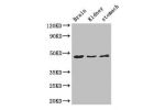 Western Blot<br />
Positive WB detected in:Mouse brain tissue,Mouse kidney tissue,Mouse stomach tissue<br />
All lanes: AGK antibody at 3ug/ml<br />
Secondary<br />
Goat polyclonal to rabbit IgG at 1/50000 dilution<br />
Predicted band size: 48,8 kDa<br /