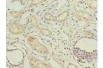 Immunohistochemistry of paraffin-embedded human kidney tissue using CSB-PA706643LA01HU at dilution of 1:100