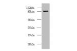 Western blot<br />
All lanes: FSCB antibody at 1.5ug/ml+ Mouse liver tissue<br />
Goat polyclonal to rabbit at 1/10000 dilution<br />
Predicted band size: 88 kDa<br />
Observed band size: 88 kDa<br />