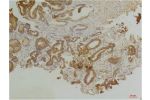 Immunohistochemical analysis of paraffin-embedded Human Prostate Tissue using Endothelin B ReceptorRabbit pAb diluted at 1:200.