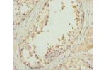 Immunohistochemistry of paraffin-embedded human