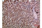 Immunohistochemical analysis of paraffin-embedded human-liver, antibody was diluted at 1:200